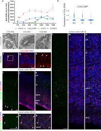 Extracellular Lgals3bp Regulates Neural
