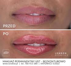 permanent makeup lips london esthetics