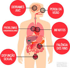 Hipertensão - Sintomas, causas, tratamento, dieta, exercícios e dicas - MundoBoaForma