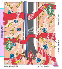 hair removal electrolysis aftercare