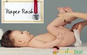 home remes for diaper rash causes