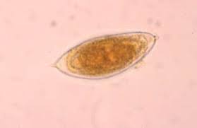 Schistosomiasis (Bilharzia): Background, Pathophysiology, Etiology
