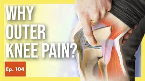 how to fix lateral knee pain for