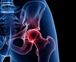 hip pain in runners is it a hip stress