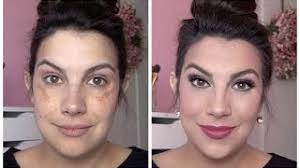 full coverage makeup for melasma