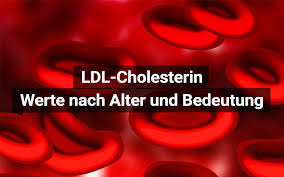 Natürliche hausmittel gegen hohen cholesterinspiegel verringern ihn ohne fett essen und cholesterin senken? Ldl Cholesterin Bedeutung Werte Tabelle Praktischarzt