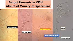 koh mount of various sles with