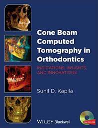 cone beam computed tomography in