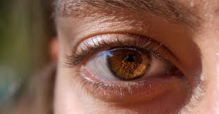 hypertensive retinopathy symptoms