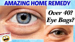 get rid of eye bags puffy under eyes