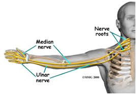 pinched nerve treatment neck arm