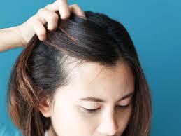 16 dry scalp treatment options and ways