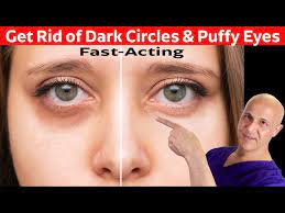 dark circles puffy eye bags