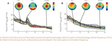 eeg channel spectraçåçæå°çµæ
