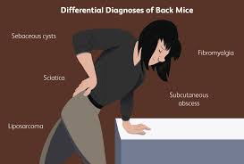 back mice symptoms diagnosis and