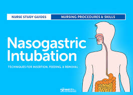 Nasogastric Intubation Insertion Procedures Technique