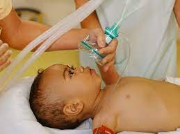 anesthetic risks in children the