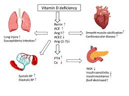 Without sufficient vitamin d, bones become brittle (in children this is called rickets and in adults it is called osteomalacia) and break more easily. Role Of Vitamin D In Pathogenesis And Severity Of Covid 19 Infection V1 Preprints