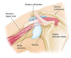 shoulder strain treatment doctor nyc