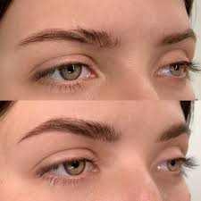 scar cover ups using microblading the