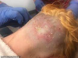 Jan 10, 2018 · it is very difficult to say as to how long bleach burns last exactly. Woman Suffers Shocking Chemical Burns From Diy Hair Bleaching Daily Mail Online