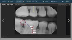 Dental Charting Software For Dental Practice Dentrix Ascend