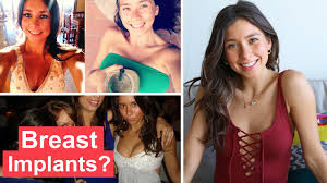DO I HAVE BREAST IMPLANTS? 