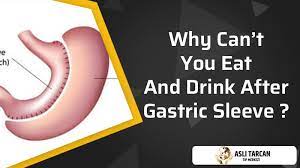 eat and drink after gastric sleeve