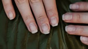 brittle nails learn all about this