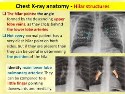 Check spelling or type a new query. Chest X Ray Fundamentals X Ray Radiology Imaging Pediatric Radiology
