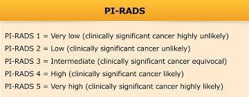 The Radiology Assistant Prostate Cancer Pi Rads V2