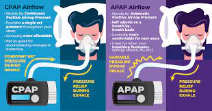 auto cpap better for your sleep apnea