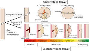 natural bone repair