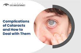 complications of cataracts and how to
