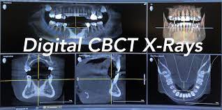 digital x rays dentist greensboro nc