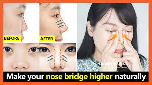 lift your nose bridge higher
