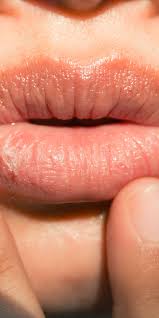 6 major causes of chapped lips and how