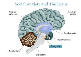 This is because while you may exhibit symptoms of if you do discover that your anxiety disorders are causing issues, or that it may be connected with bipolar disorder if you have that as well, then know. Causes Of Social Anxiety Bridges To Recovery