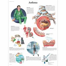 The base color array for google charts. Anatomical Charts And Posters Anatomy Charts Asthma Laminated Chart