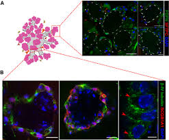 Can now be found as a hooker on the net. Multilineage Murine Stem Cells Generate Complex Organoids To Model Distal Lung Development And Disease The Embo Journal
