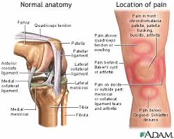 knee pain medlineplus cal encyclopedia