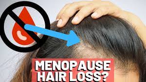 does menopause cause hair loss find