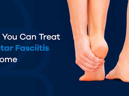 how you can treat plantar fasciitis at