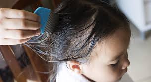 Lice lay nits on hair shafts close to the scalp, where the temperature is perfect for keeping warm until they hatch. How To Get Rid Of Lice In Your Child S Hair Babycenter