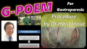g poem gastric per endoscopic