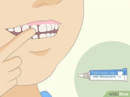 Using the gauze pad, grasp the tooth and pull up firmly but gently. The 3 Best Ways To Pull Out A Tooth Without Pain Wikihow