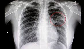 It first appears too complicated to read the chest xrays because we barely know what. Ai Detects Key Chest X Ray Findings Within 10 Seconds Axis Imaging News