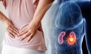 What is in between the internal parts of the body. Lower Back Pain The Signs Your Back Pain Could Be Caused Be Kidney Stones Express Co Uk
