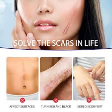 scar hyperplasia scar silicone repair