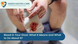blood in your stool what it means and